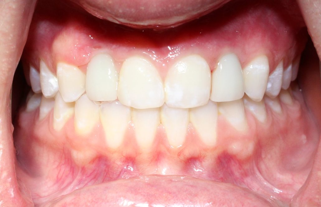 The best dental implants dentist, Dentists for implants