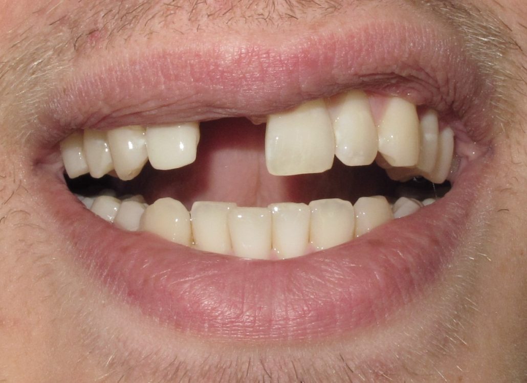 The best dental implants dentist, Dentists for implants