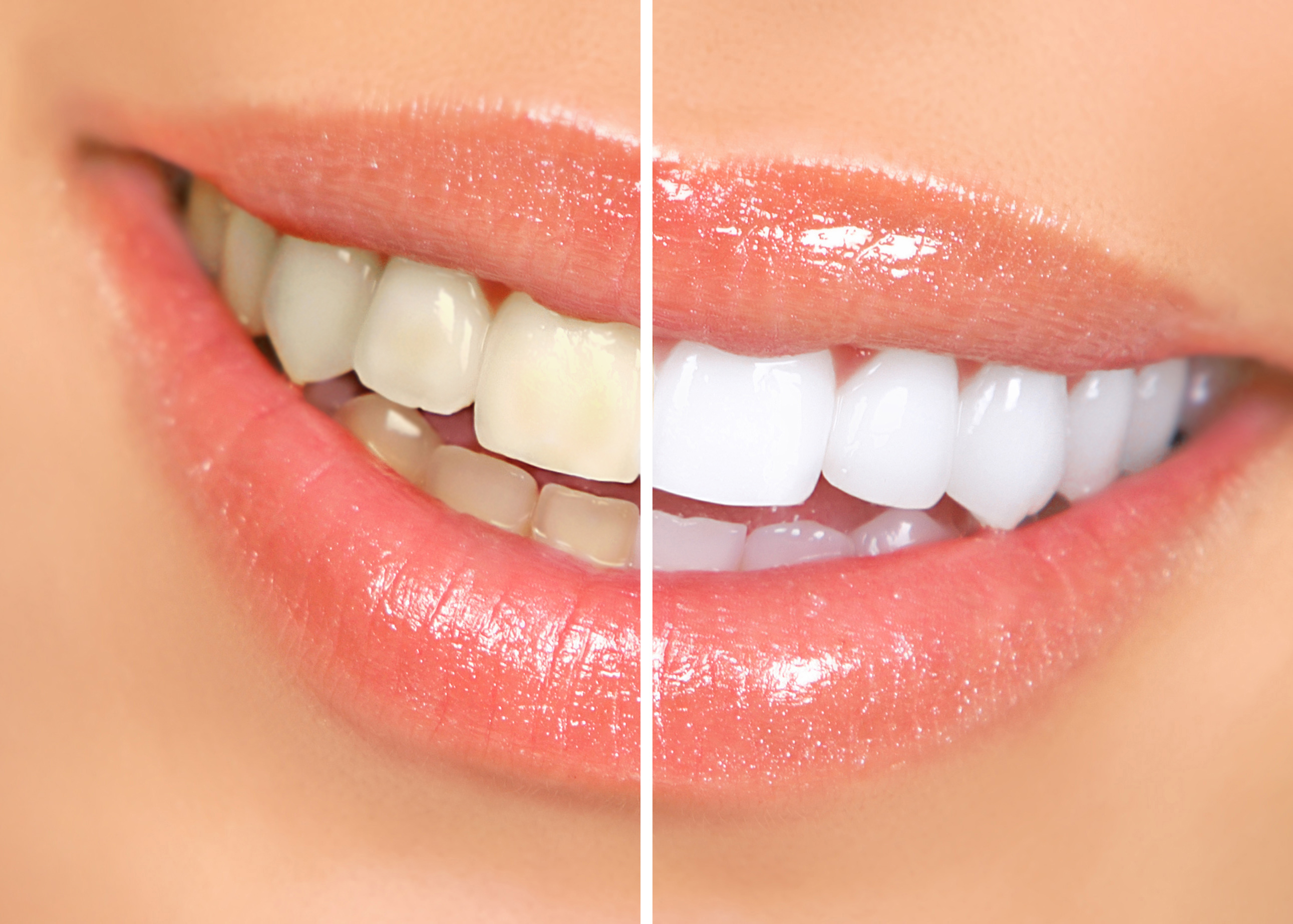 A guide to the different types of cosmetic dentistry